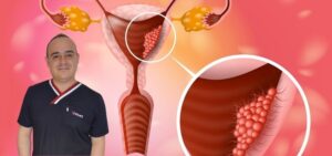 Rahim Ağzı Kanseri: Nedenleri, belirtileri ve tedavi yöntemleri